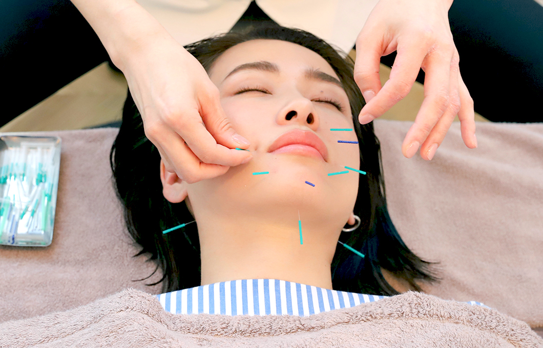 song美容鍼ベーシックコース